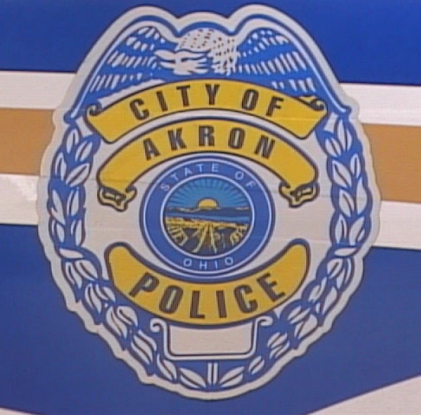 Akron Police Officer Who Shot, Injured 15 Year Old, Fired
